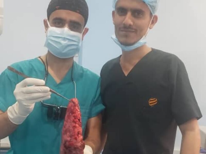 جراح مصري يجري عملية نادرة في مستشفى البدر الدولي بمحافظة اب